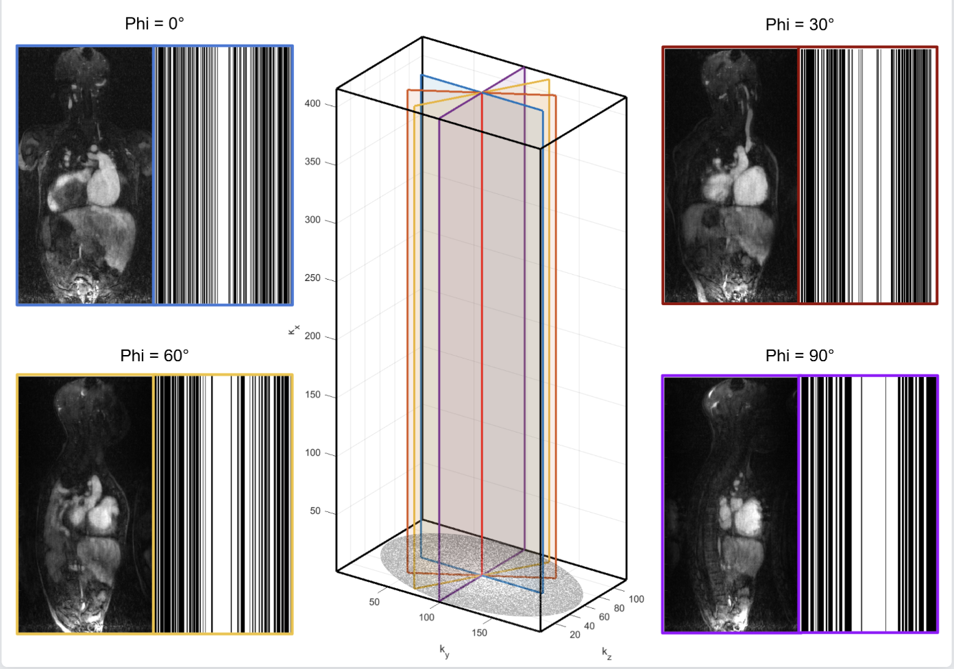 5D free-running CMR reconstruction